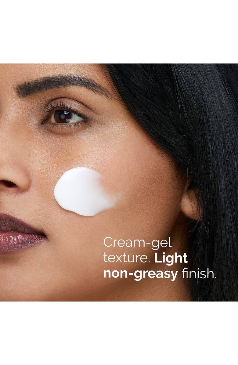 Azelaic Acid 10% Suspension Brightening Cream