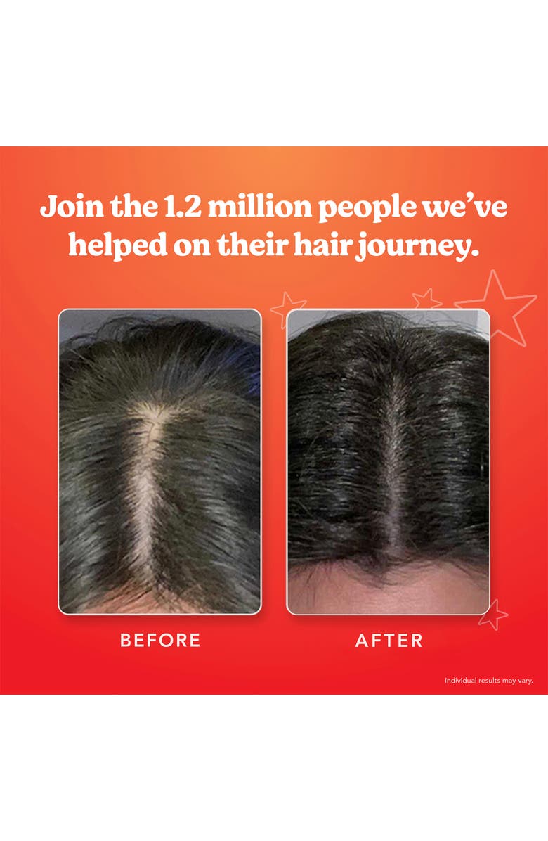 HAIRTAMIN Scalp Serum, Alternate, color, NO COLOR