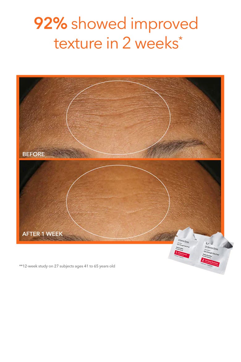 Alpha Beta® Peel Vault Set, Alternate, color, NO COLOR