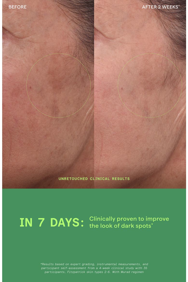 Rapid Dark Spot Correcting Serum, Alternate, color, NO COLOR