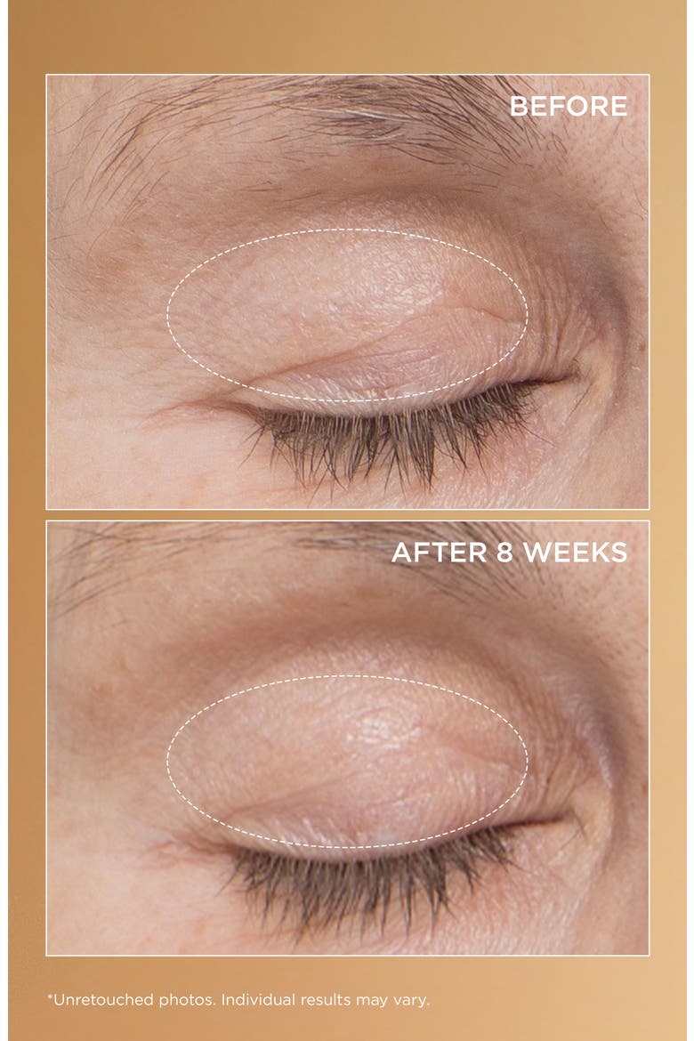 Neuropeptide Eyelid Lift Serum, Alternate, color, NO COLOR