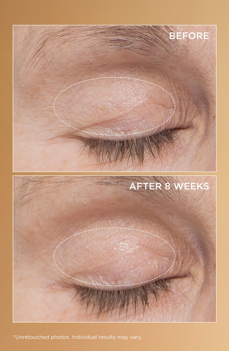 Perricone MD Neuropeptide Eyelid Lift Serum, Alternate, color, 