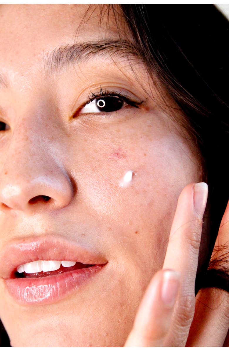 Dr. Devgan Scientific Beauty Acne Control Serum, Alternate, color, NO COLOR