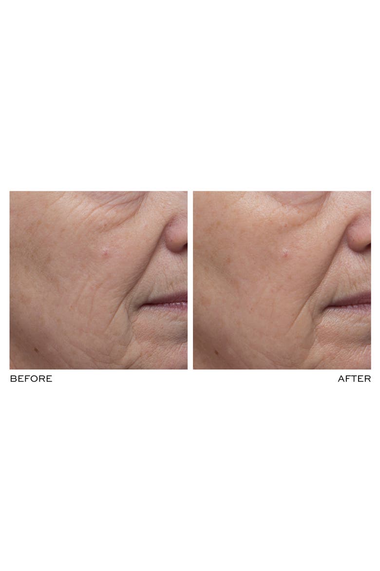 ULTRA SMART Pro-Collagen Aqua Infusion Mask, Alternate, color, NO COLOR