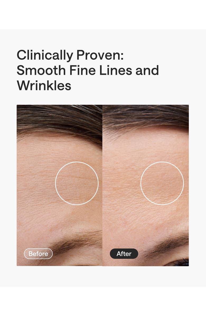 ULIKE ReGlow 4-in-1 LED Light Therapy Mask, Alternate, color, Silver