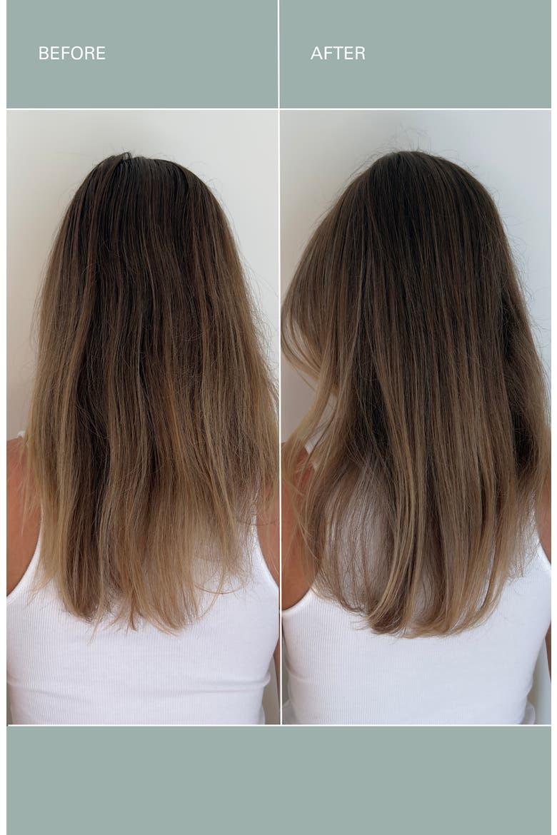 Healthy Hair & Scalp Kit $181 Value, Alternate, color, NO COLOR