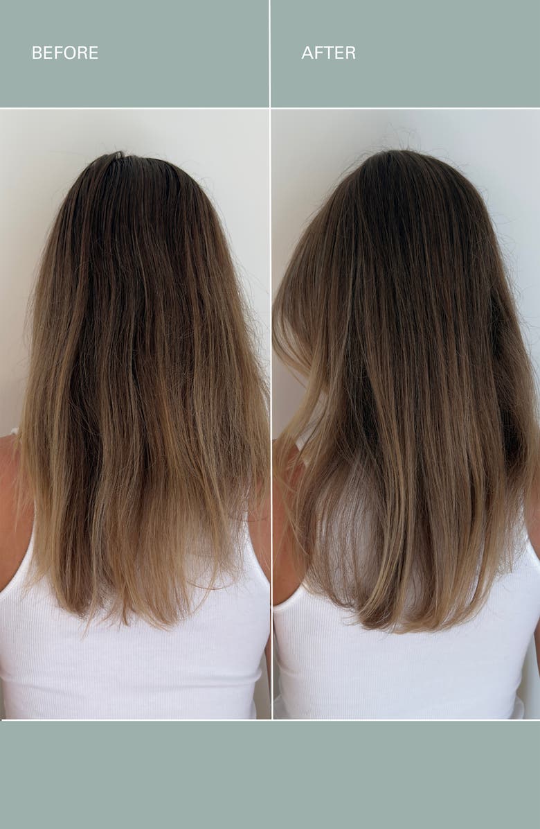 ROZ Healthy Hair & Scalp Kit $181 Value, Alternate, color,