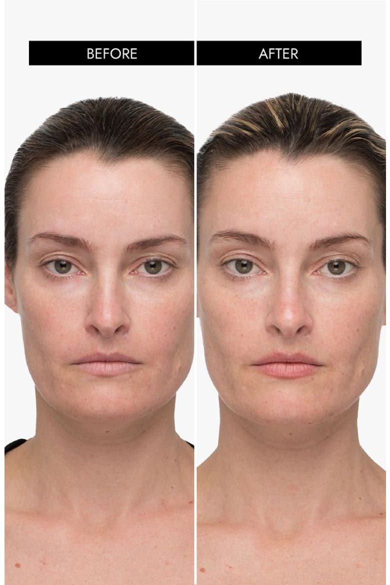 MyoLift QT Plus Smart Microcurrent Facial Toning Device, Alternate, color, White