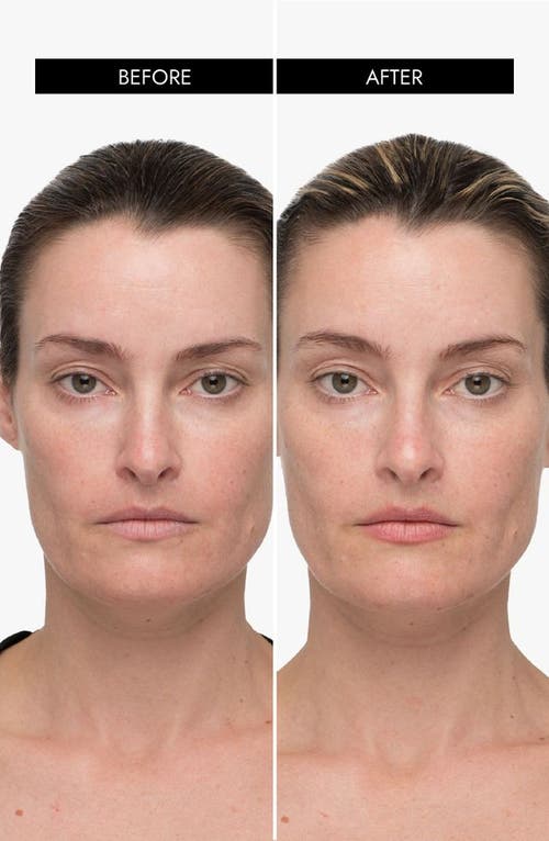 7e Wellness Myolift Qt Plus Smart Microcurrent Facial Toning Device In White