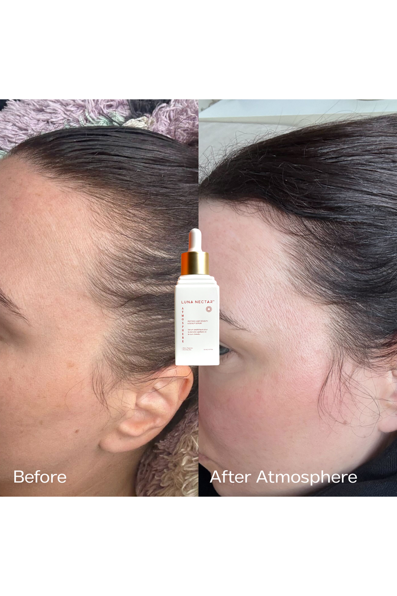 Atmosphere Multi-Peptide Hair Density & Scalp Serum, Alternate, color, 1.01 oz.