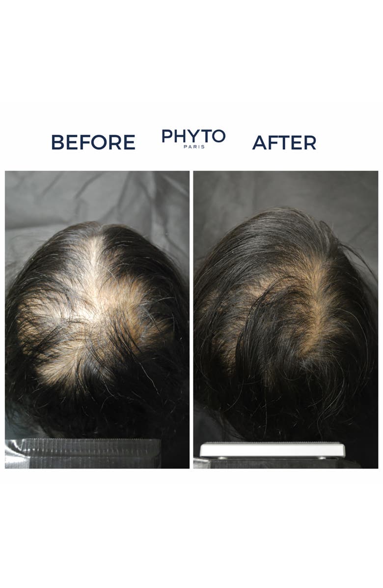 PHYTO CANE Women Invigorating Shampoo, Alternate, color,