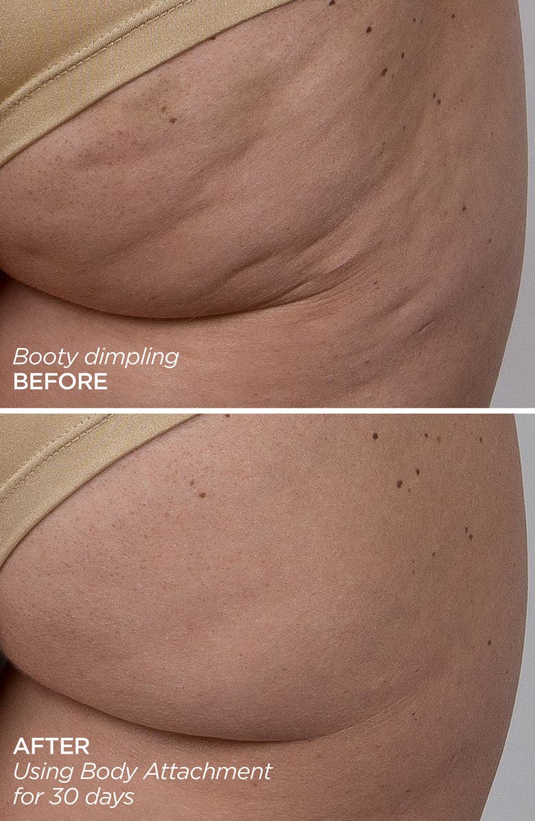 BeautyBio GloPRO<sup>®</sup> BODY MicroTip<sup>™</sup> Attachment Replacement Head, Alternate, color,