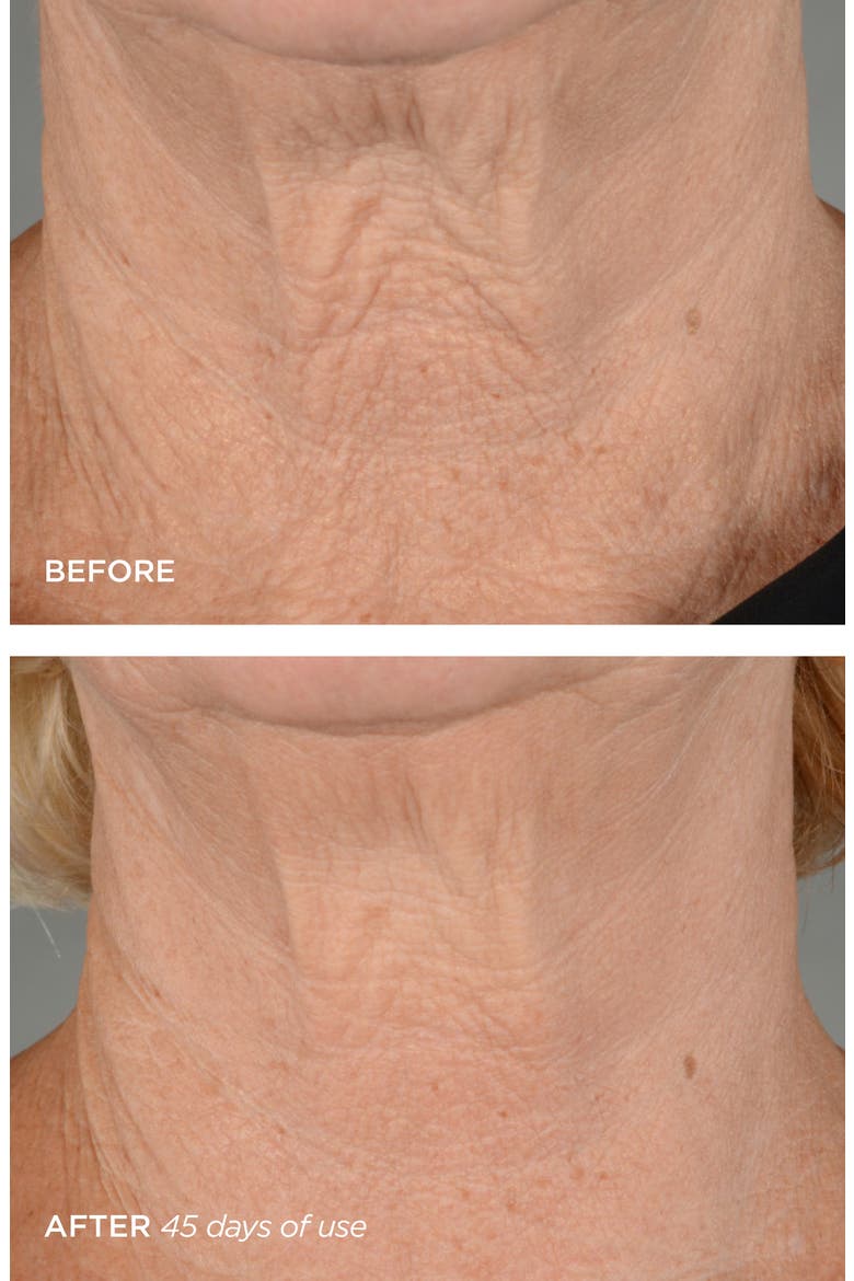 R45 The Lift 3-Phase Advanced Neck Contouring Treatment (Nordstrom Exclusive), Alternate, color, NO COLOR