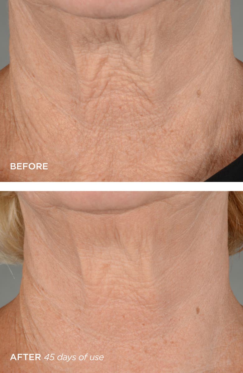 BeautyBio R45 The Lift 3-Phase Advanced Neck Contouring Treatment, Alternate, color, 