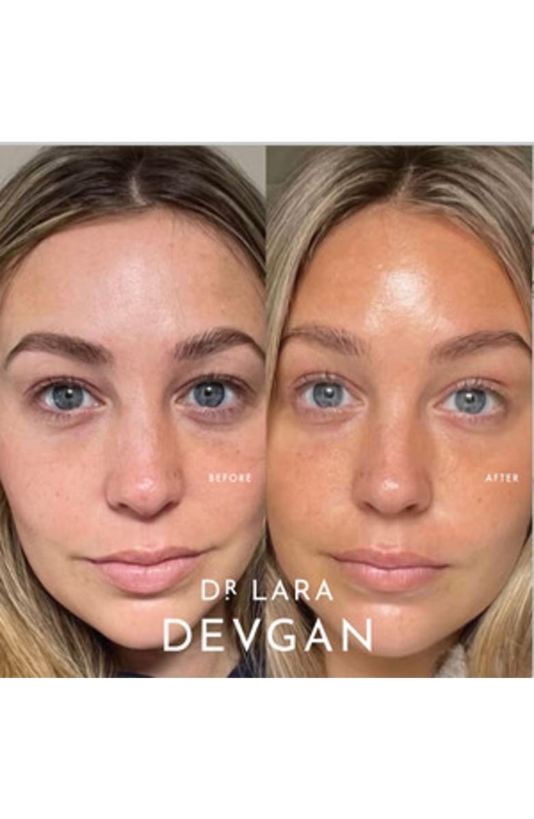 Dr. Devgan Scientific Beauty Polypeptide Eye Cream, Alternate, color, NO COLOR