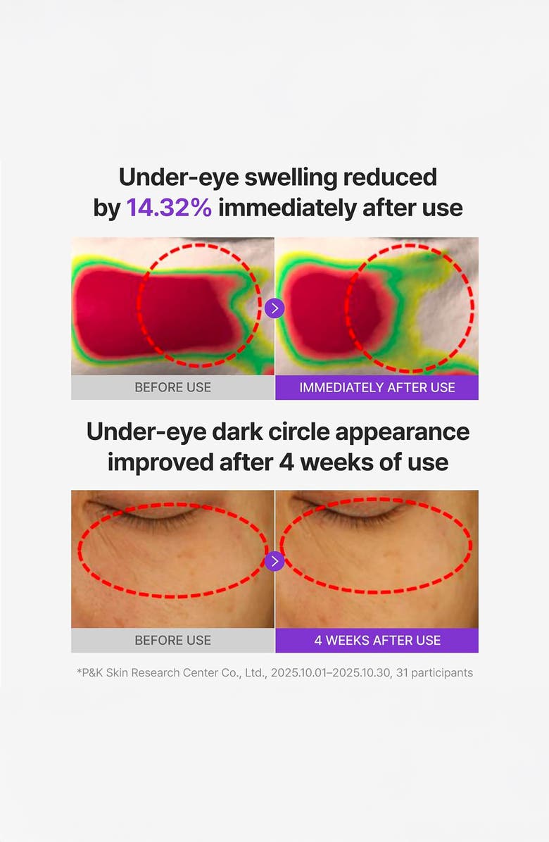 Centellian24 360 Shot PDRN Glowing Eye Patches, Alternate, color, 
