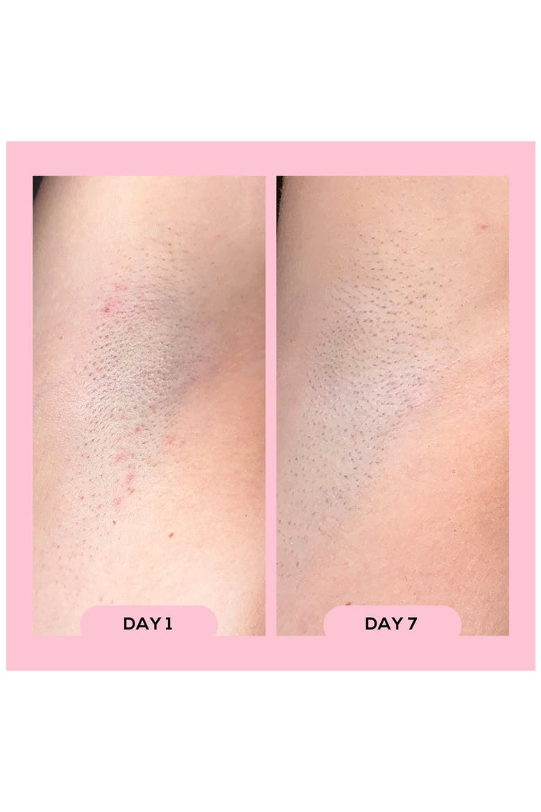 Après Shave Ingrown Hair & Razor Bump Roll-On, Alternate, color, PINK