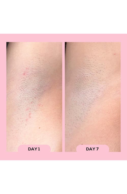 Megababe Après Shave Ingrown Hair & Razor Bump Roll-on In Pink