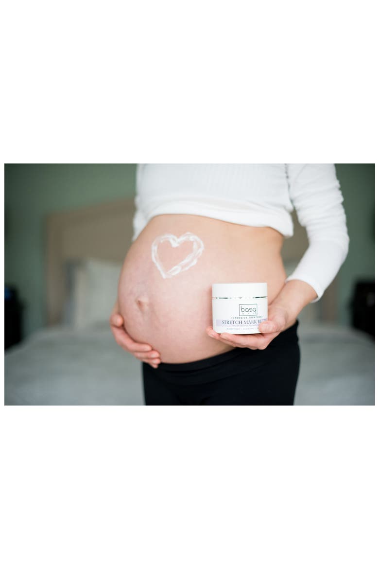 Intensive Treatment Stretch Mark Butter, Alternate, color, WHITE