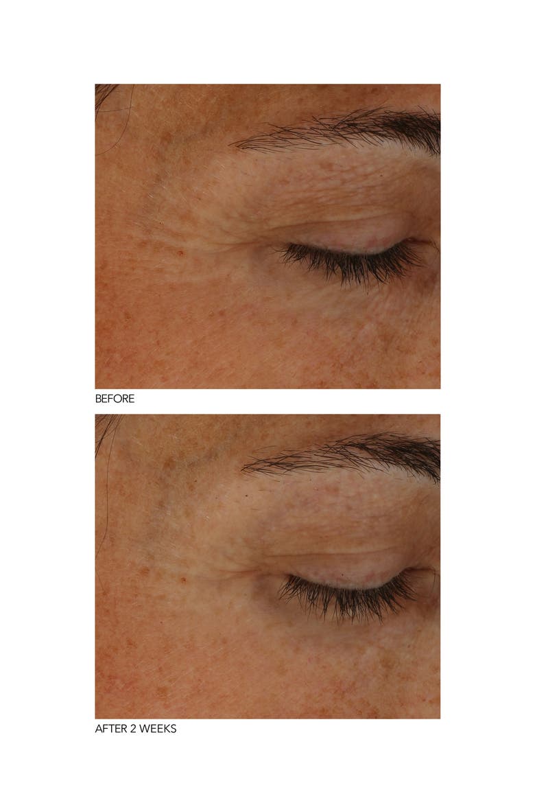 B3Adaptive SuperFoods™ Stress SOS Eye Cream, Alternate, color, NO COLOR