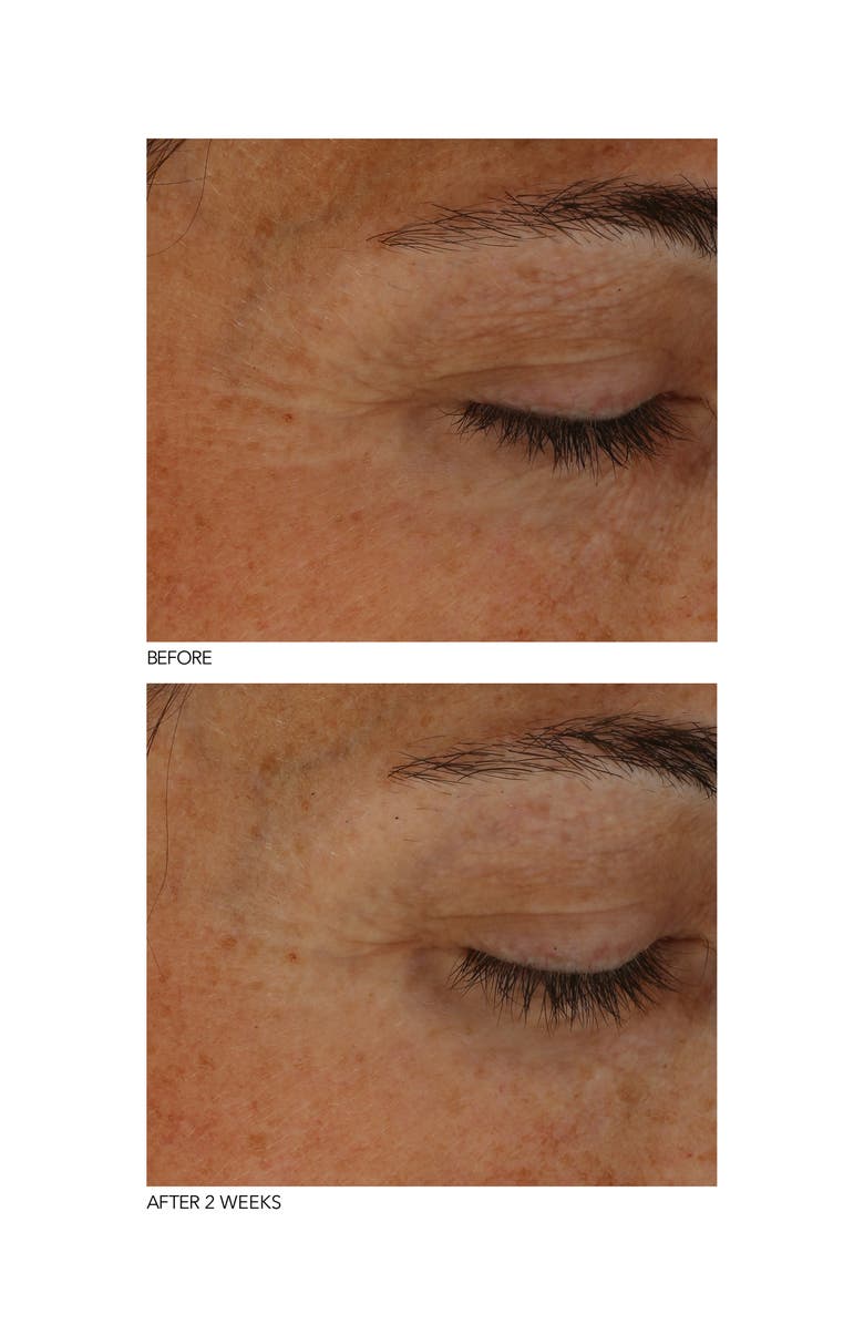 Dr. Dennis Gross Skincare B3Adaptive SuperFoods<sup>™</sup> Stress SOS Eye Cream, Alternate, color, 