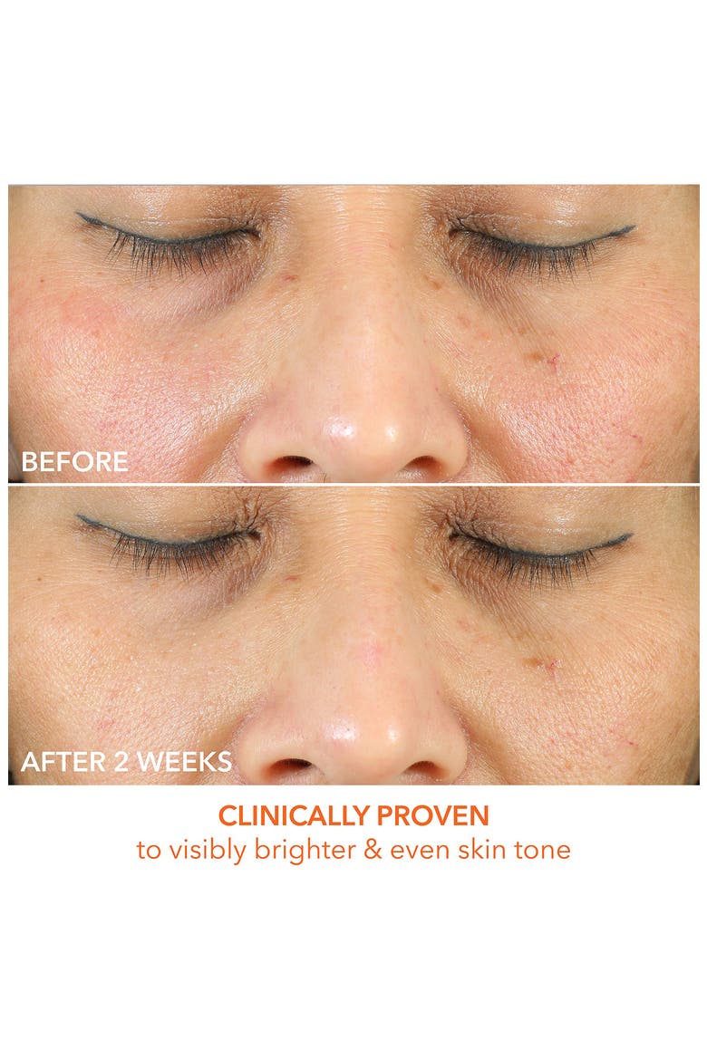 Vitamin C Lactic Oil-Free Radiant Moisturizer, Alternate, color, NO COLOR