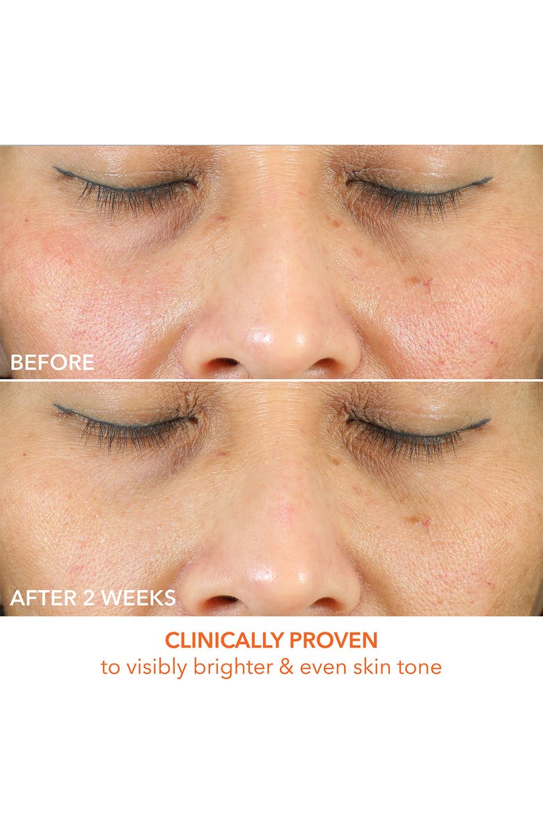 Dr. Dennis Gross Skincare Vitamin C Lactic Oil-Free Radiant Moisturizer, Alternate, color,