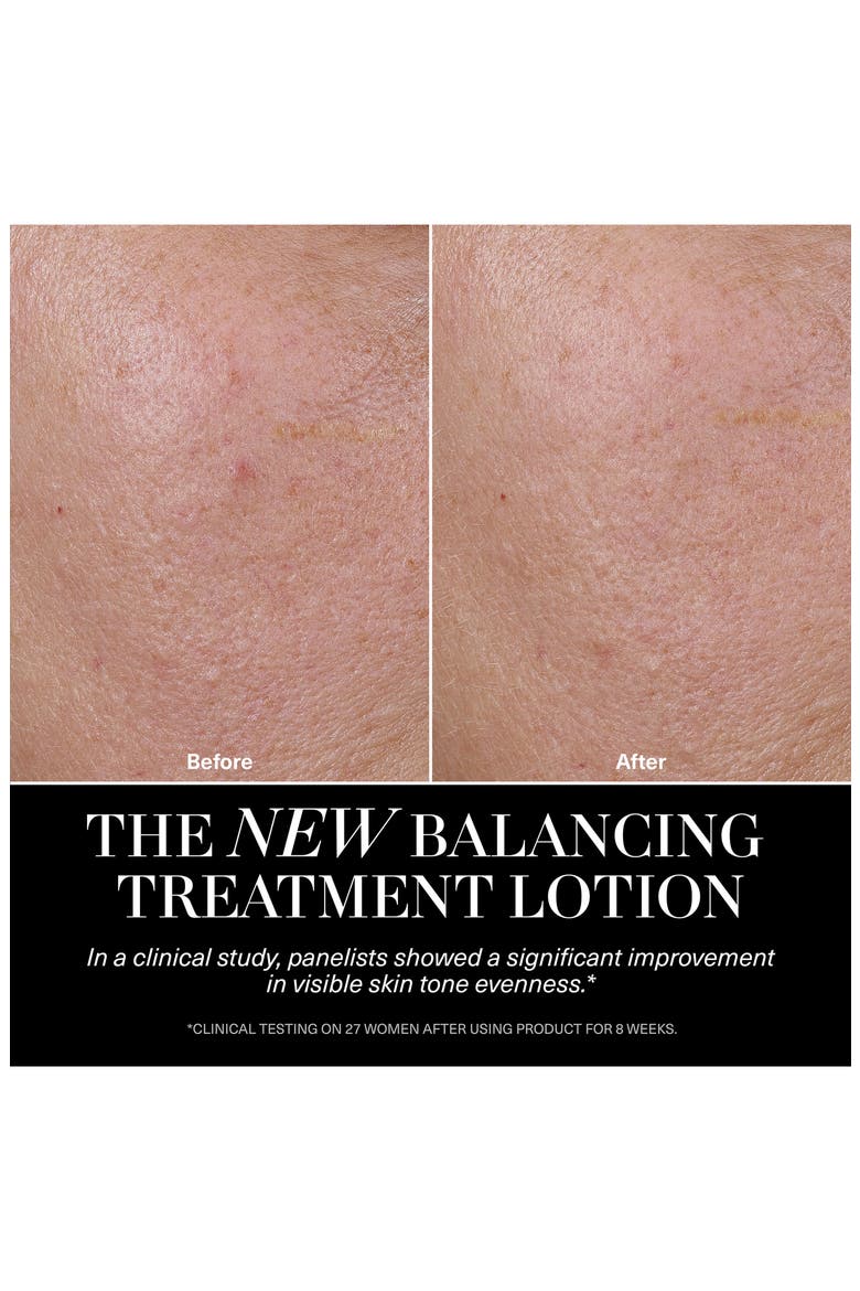 The Balancing Treatment Lotion, Alternate, color, NO COLOR