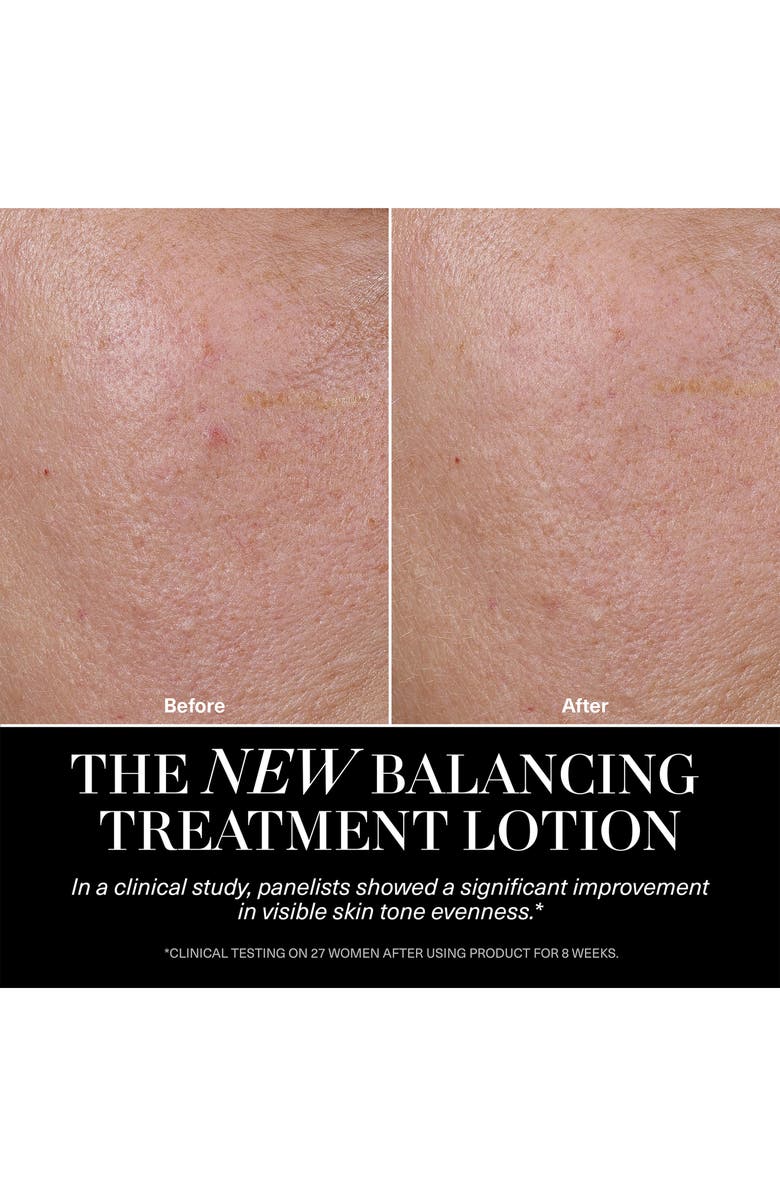 La Mer The Balancing Treatment Lotion, Alternate, color,