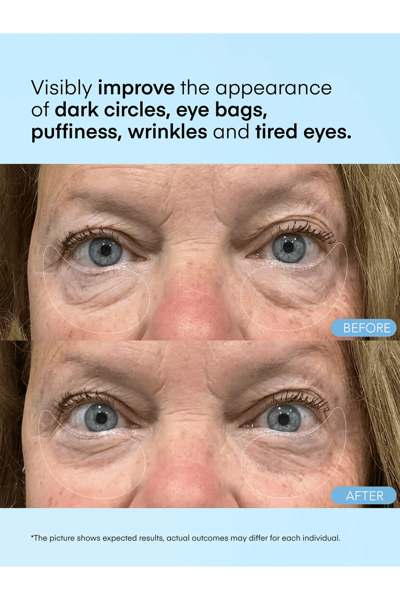 Caffeine Hyaluronic Acid Eye Gel Patch, Alternate, color, No Color