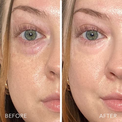 Doll 10 Beauty T.c.e Luminous Undereye Corrector In Amber