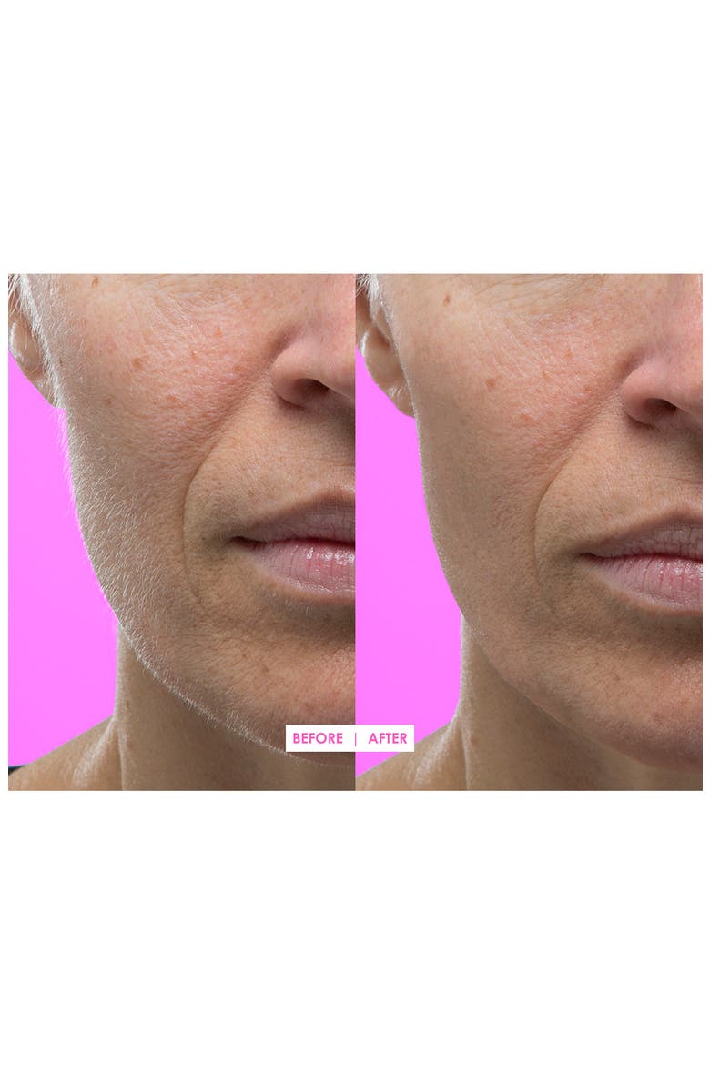 Hot Pink Facial Exfoliating Device, Alternate, color, NO COLOR