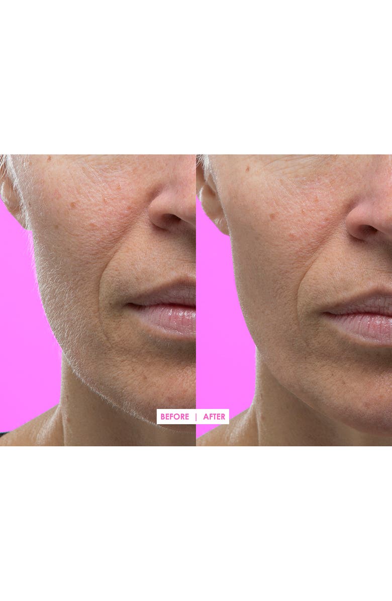 DERMAFLASH Hot Pink Facial Exfoliating Device, Alternate, color, 