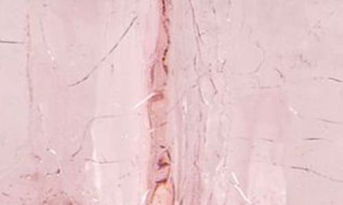 Kosta Boda Crackle Pink Glass Bowl In Pink