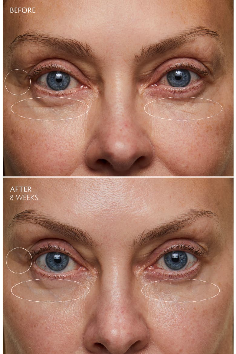 Enhancing Eye Contour Cream Supreme, Alternate, color, NO COLOR