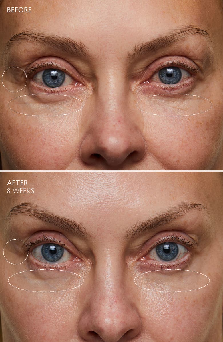 Clé de Peau Beauté Enhancing Eye Contour Cream Supreme, Alternate, color, 