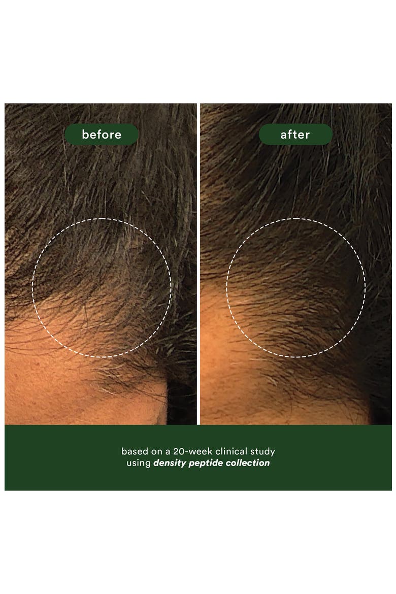 Hair Density Peptide Serum, Alternate, color, NO COLOR