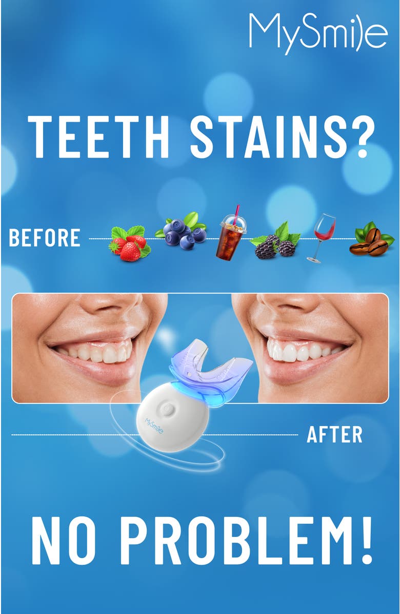 MySmile Original Teeth Whitening Kit with 5 LED Light, 35% CP Gel, Alternate, color, White