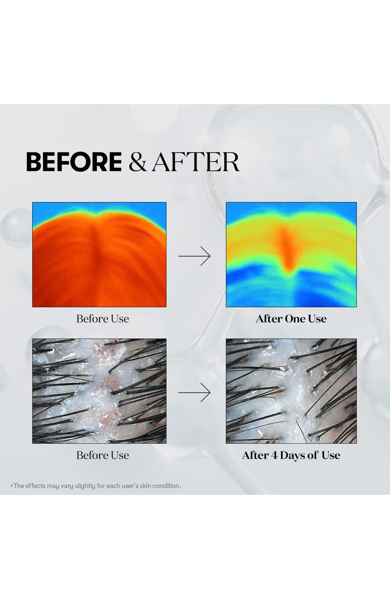 VT COSMETICS PDRN Reedle Shot Hair Ampoule 100 dL, Alternate, color, Silver