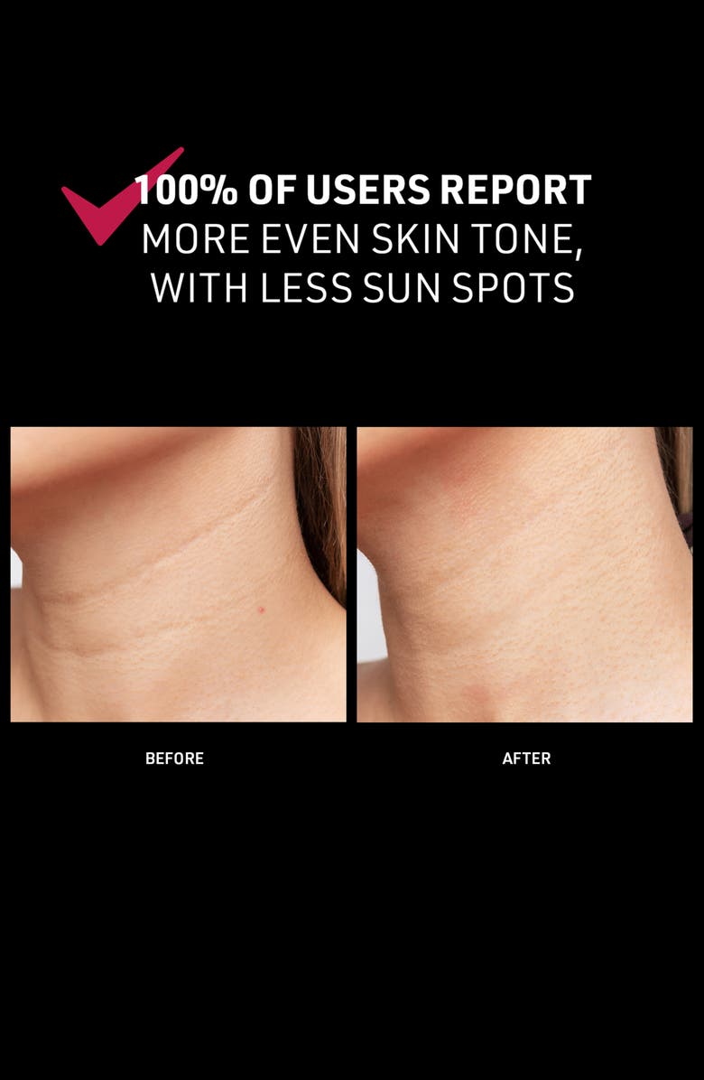 FOREO FAQ<sup>™</sup> 211 Silicone LED + Near-Infrared Neck & Décolleté Mask, Alternate, color,