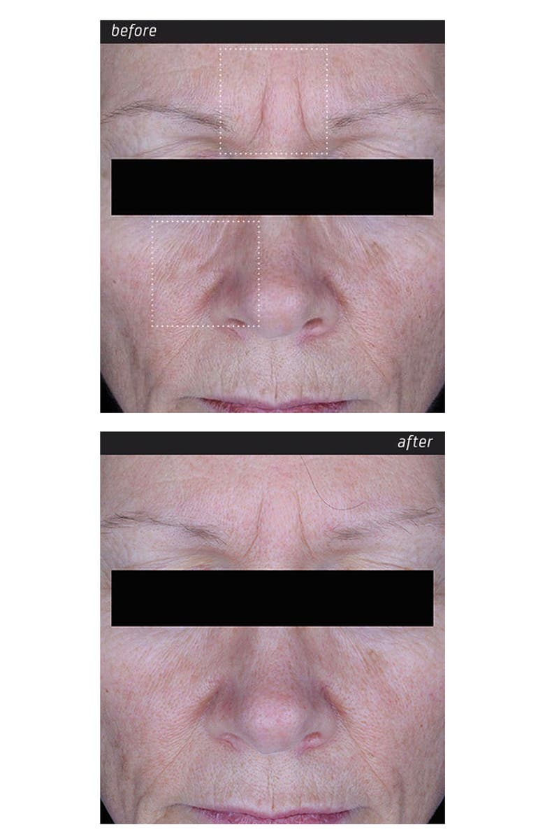 Blue Lagoon Iceland BL+ The Serum & BL+ The Eye Serum Set, Alternate, color, 