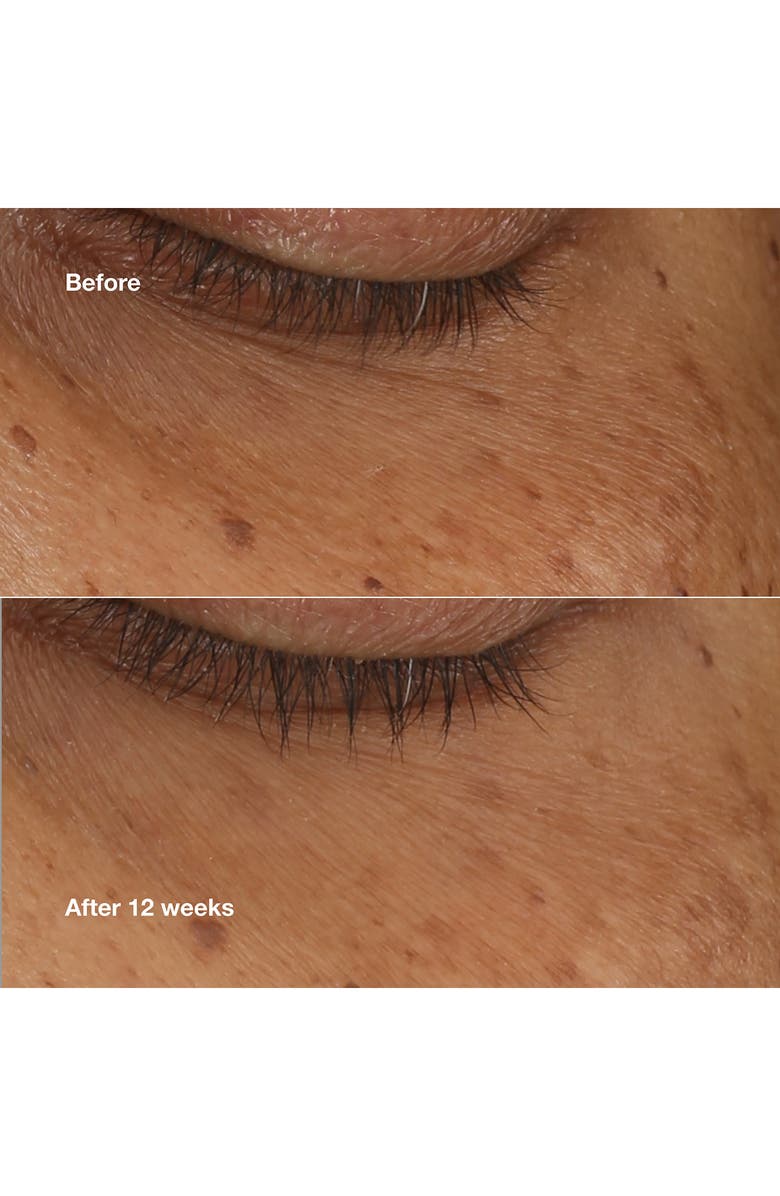 Clinique All About Eyes Brightening Serum, Alternate, color, 