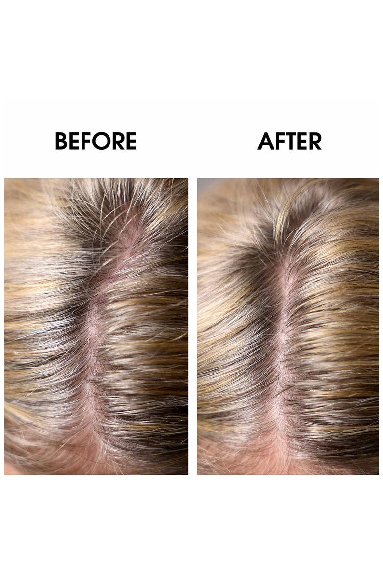 Huile Apaisante Soothing Treatment for Sensitive Scalp, Alternate, color, NO COLOR