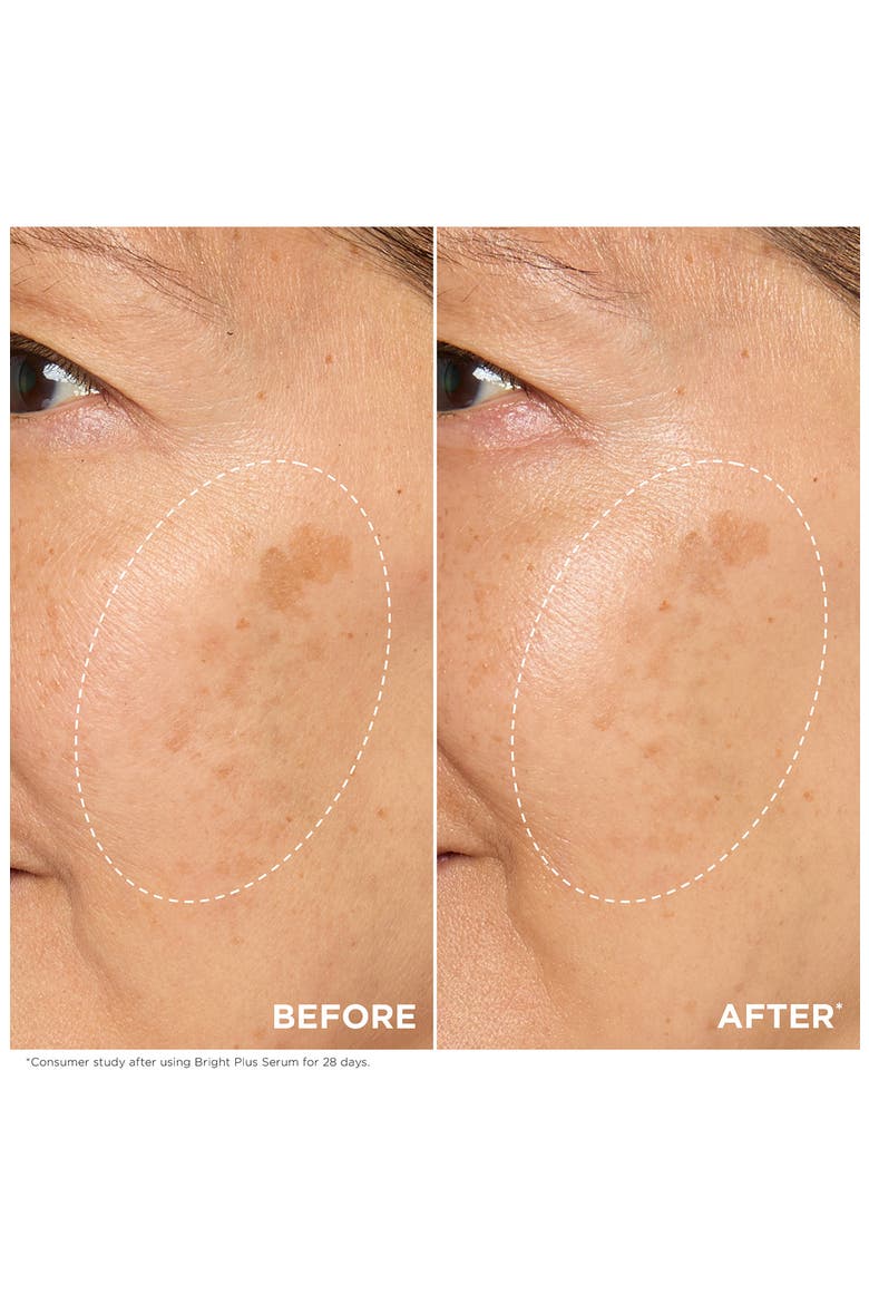 Bright Plus Brightening Vitamin C & Niacinamide Dark Spot Serum, Alternate, color, NO COLOR