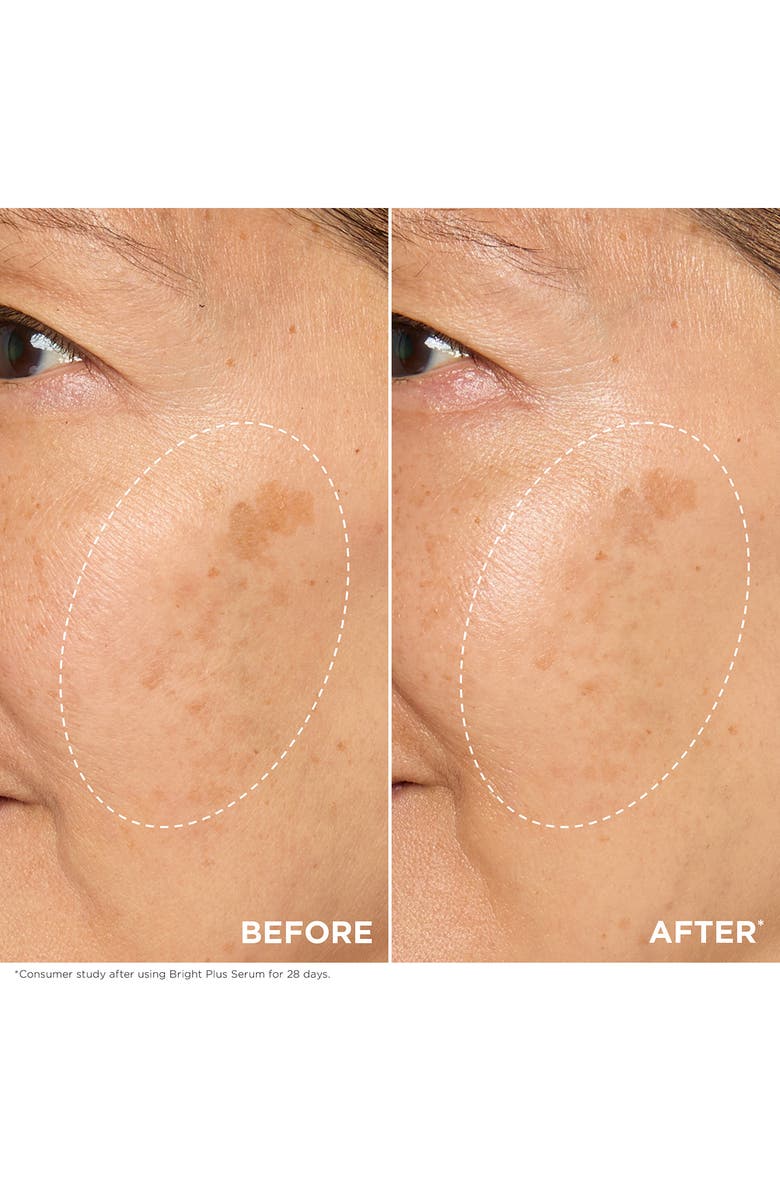 Clarins Bright Plus Brightening Vitamin C & Niacinamide Dark Spot Serum, Alternate, color,