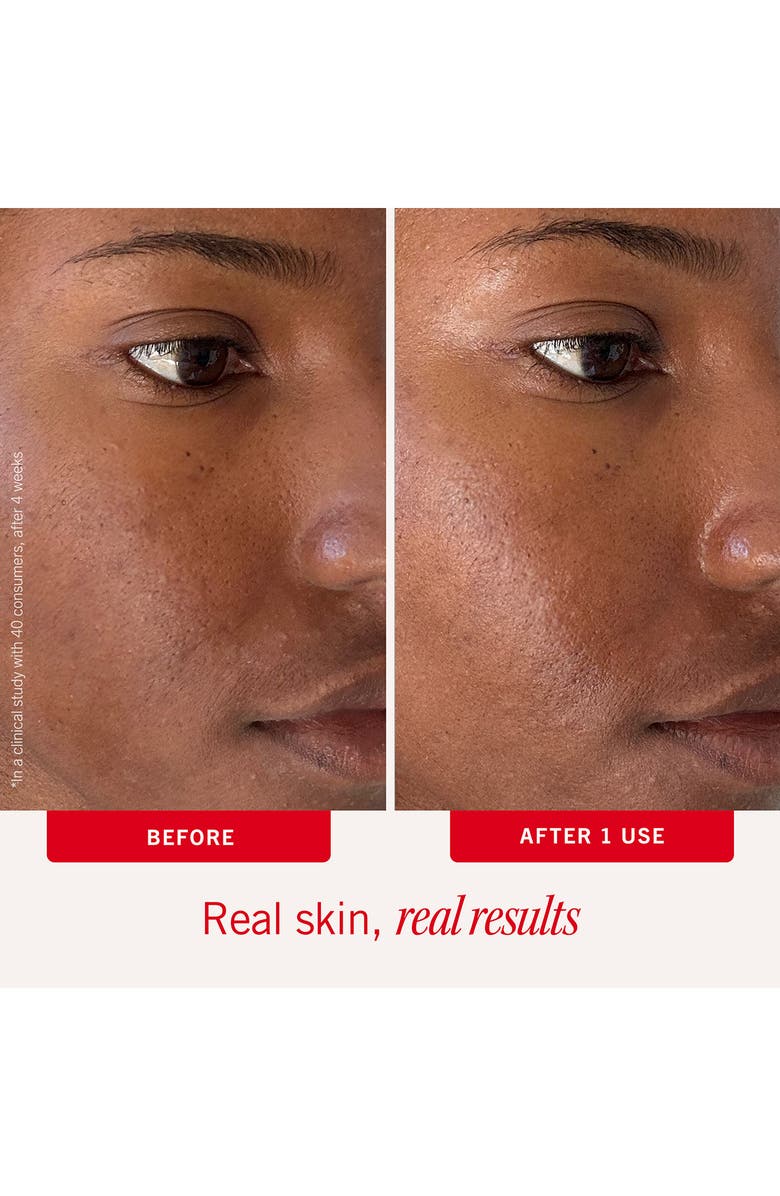 First Aid Beauty Ultra Repair Hydrating Pillow Pads, Alternate, color,