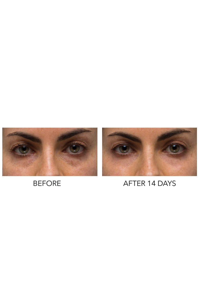 Hyaluronic Marine Dew It Right Eye Gel, Alternate, color, NO COLOR
