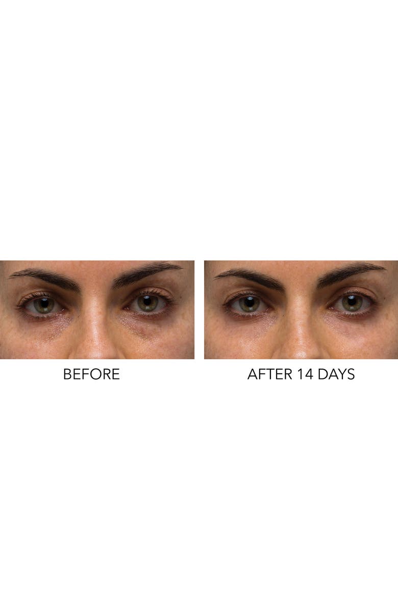 Dr. Dennis Gross Skincare Hyaluronic Marine Dew It Right Eye Gel, Alternate, color,