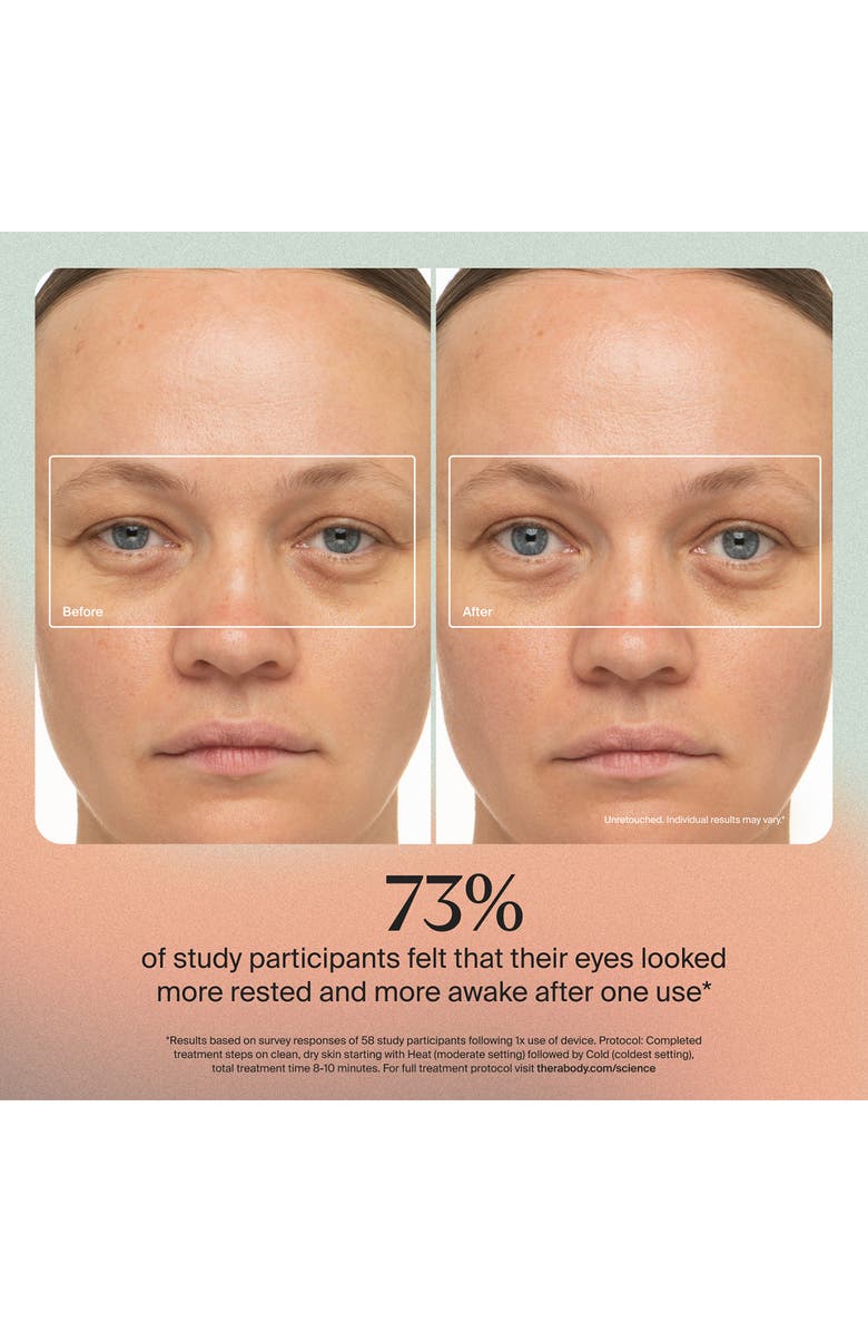 Therabody TheraFace Depuffing Wand, Alternate, color, White