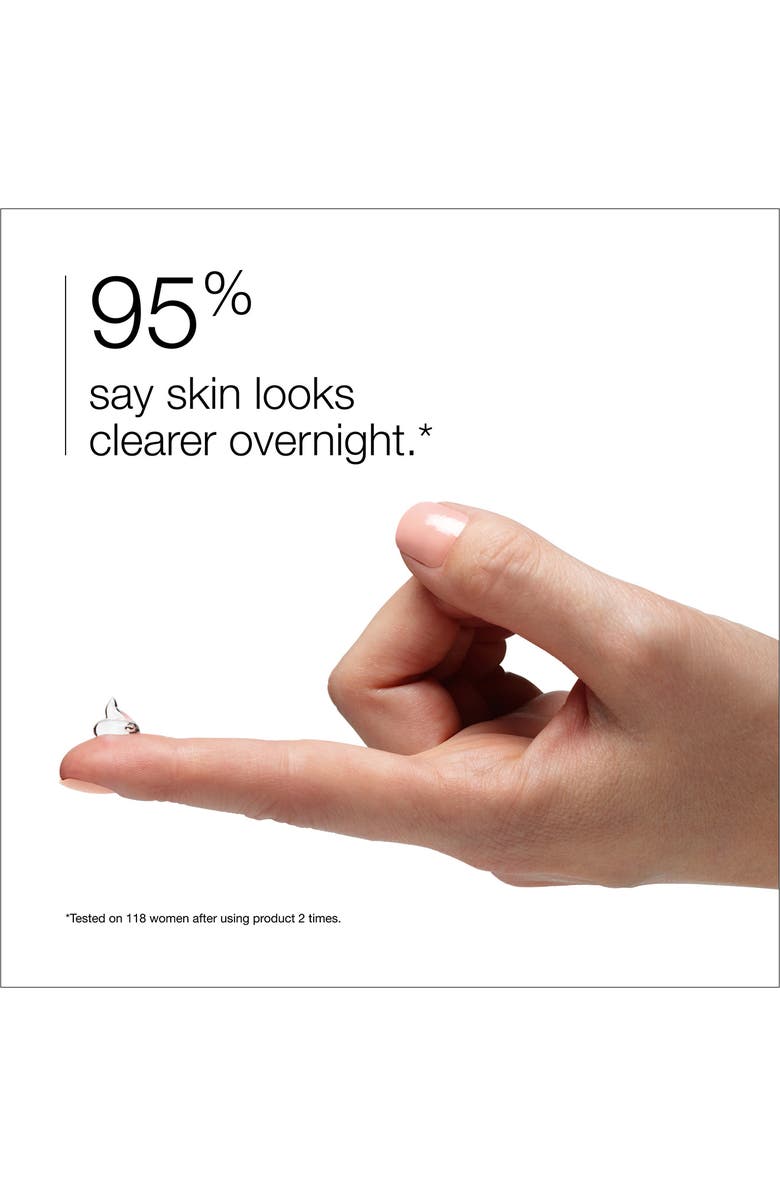 Clinique Acne Solutions Clinical Clearing Gel, Alternate, color, 